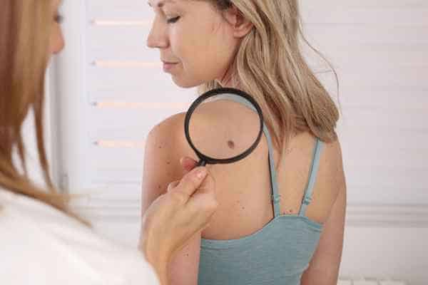 What Are Traditional Skin Lesion Removal Methods Hampstead?