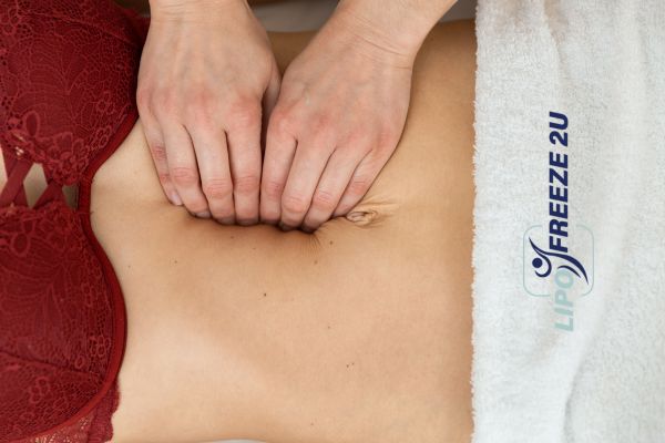 diastasis recti treatment Hampstead
