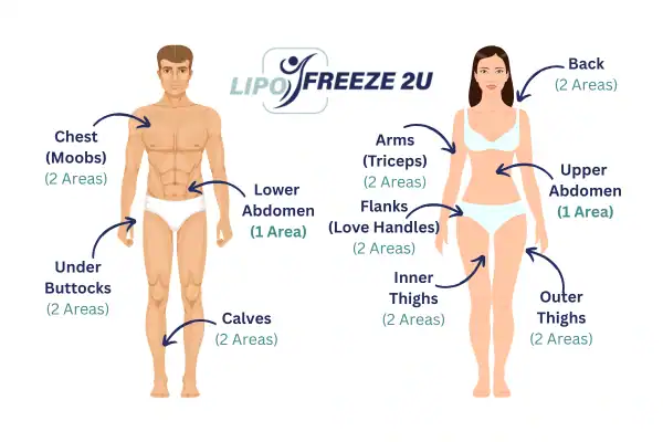 Areas you can have fat freezing treatment Hampstead