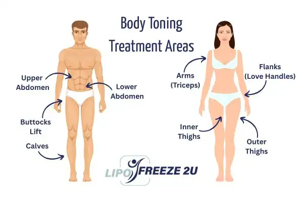 Graphic showing where you can have Body toning Treatment Hampstead on your body