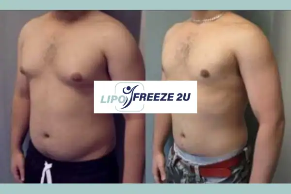 How Long Does It Take to See Results Hampstead?