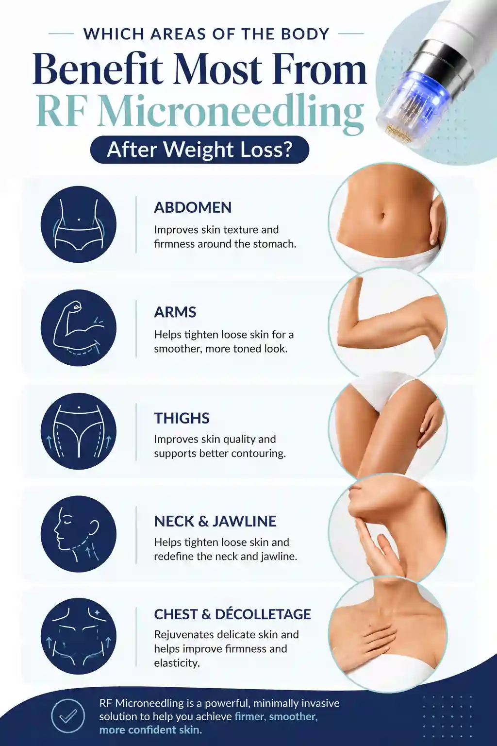 Which Areas of the Body Benefit Most From RF Microneedling After Weight Loss Hampstead